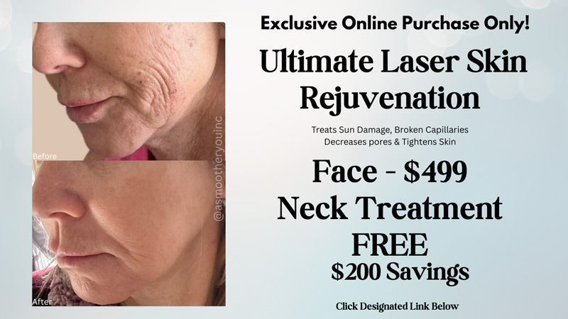 Ultimate laser skin rejuvenation banner.