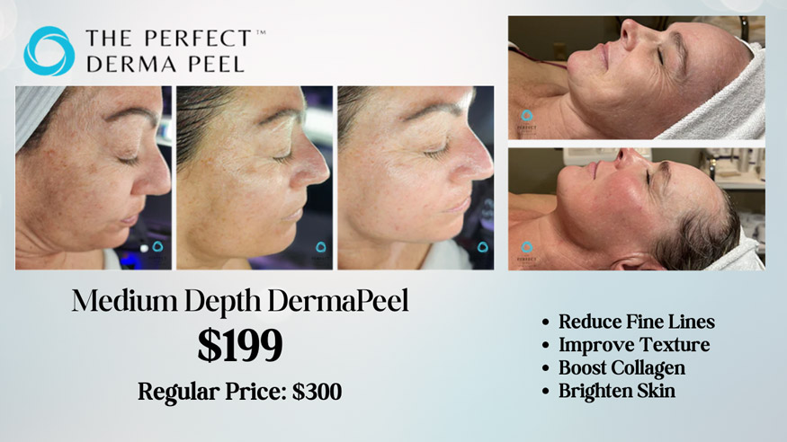 Perfect DermaPeel